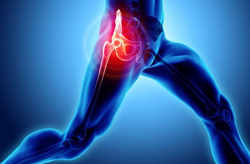 Hip Flexor Pain in Triathletes