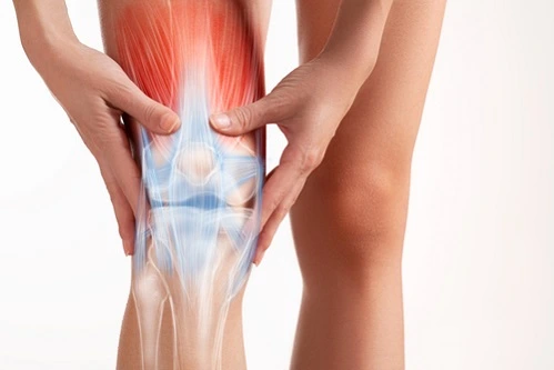 Side Effects Of Meniscus Tear Surgery