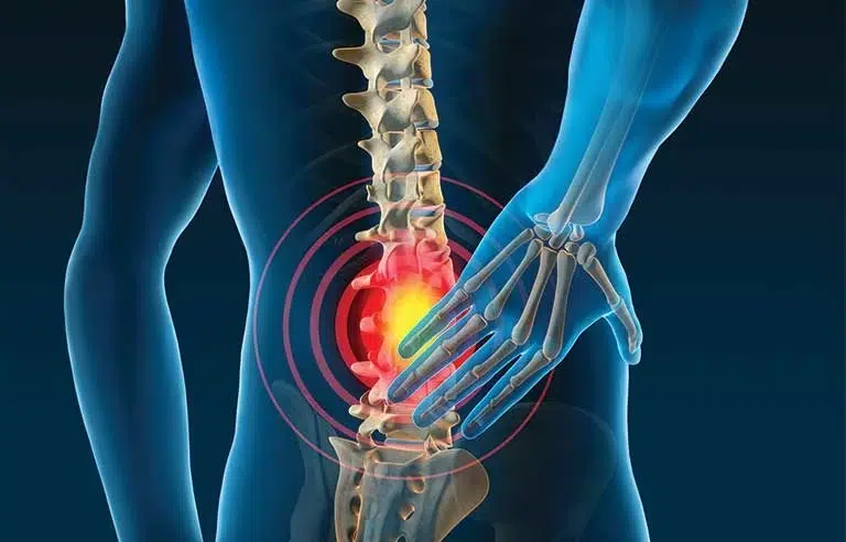 This Image Depicts Back Pain Treatment in Singapore